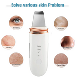 Premium Deep Cleanse Ultrasonic Skin Scrubber