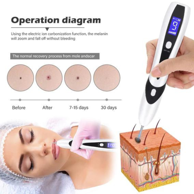 Proderma Laser Spot Mole Removal Pen